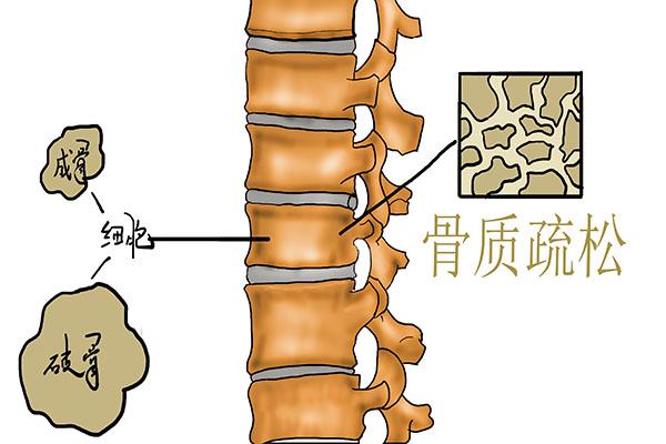 14个迹象提醒身体该动了（出现5个信号暗示身体该）(3)