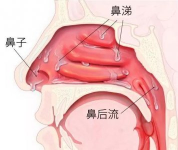 ​鼻屎是怎么形成的（鼻屎形成原因）