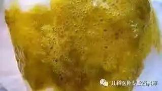 宝宝大便图鉴：便便里竟藏着疾病秘密